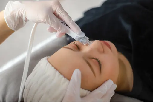 【お写真モニター】毛穴洗浄3回