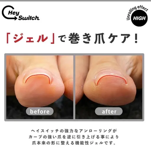 巻き爪ケア【HeySwitch】モニター募集　1本5,500円→3,500円