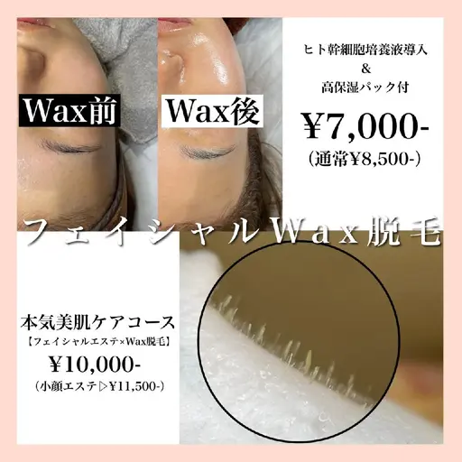 フェイシャルWAX脱毛¥7000！ヒト幹細胞培養液導入でツルピカお肌に！！