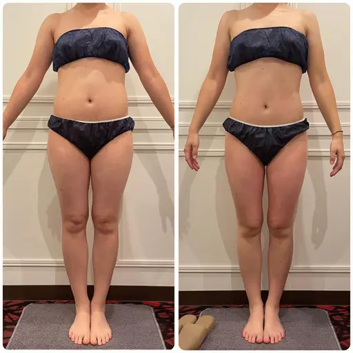 💥「今年の疲れ、今年のうちに！」デトックス痩身クーポン💥