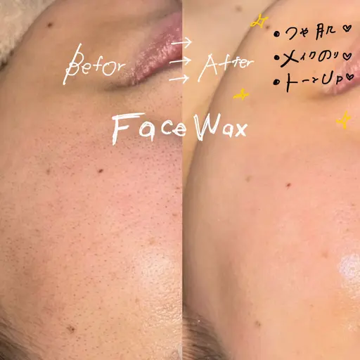 face wax✨フェイスワックスで叶える💆‍♀️韓国艶肌🇰🇷✨トーンアップ🤍メイクノリ💄美肌.艶肌.水光肌○