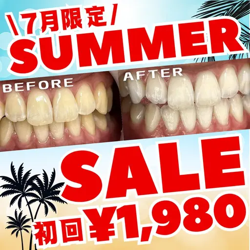 【7月限定🌺サマーセール🉐】8分照射×2回のお手軽セルフホワイトニング💎この夏、白い歯で輝く笑顔に🦷🌞