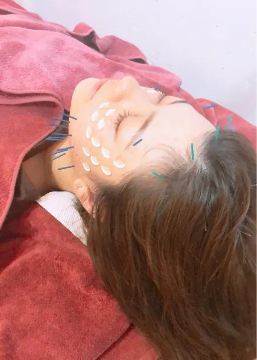 早割⭐️朝9時ご予約限定⭐️美容鍼＆ボディメンテナンス⭐️90分コース