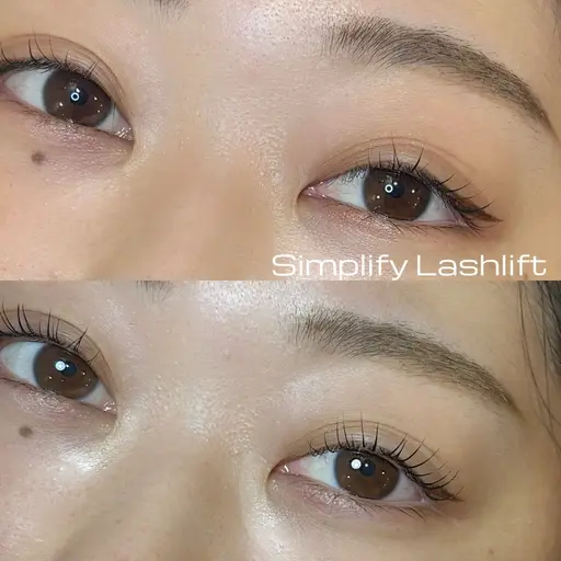 モニター価格【シンプリフィラッシュリフト】