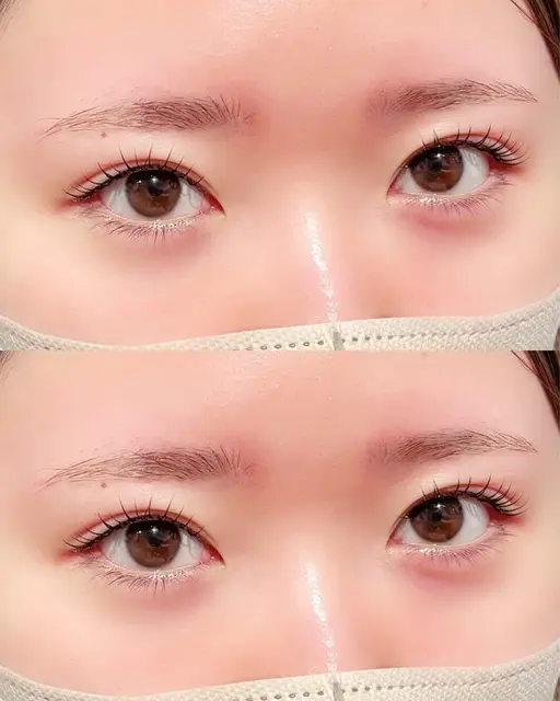 【人中短縮効果💗】似合わせまつ毛パーマ➕下まつ毛パーマ　(ケラチンTR＋束間コーティング付き💫)