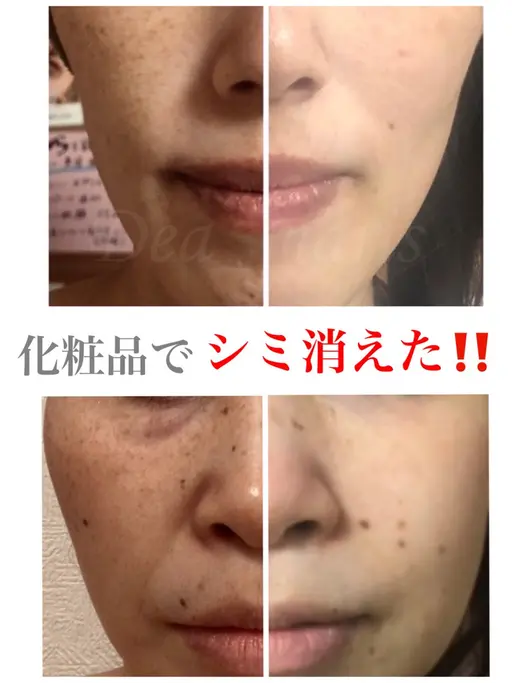 【初回・コンテスト受賞記念 先着3名限定】オーダーメイドフェイシャル初回体験15000円→8000円