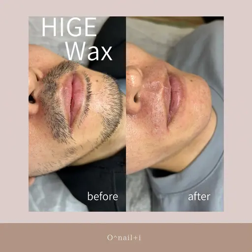 （メンズ）フェイシャルWax（眉毛・ひげ込）