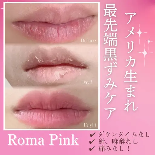【ローマピンク🩷無料カウンセリング】