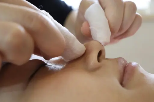 毛穴エクストラクション