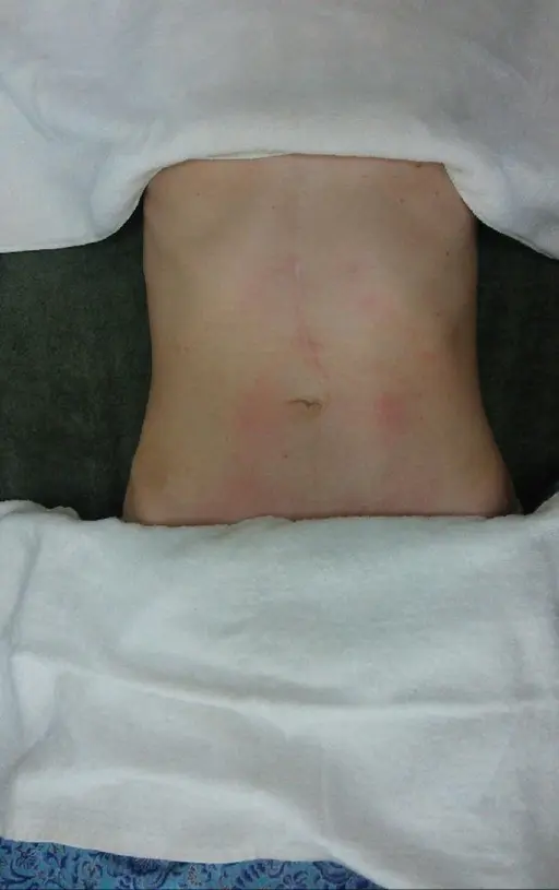 お腹のケアショートコース60分