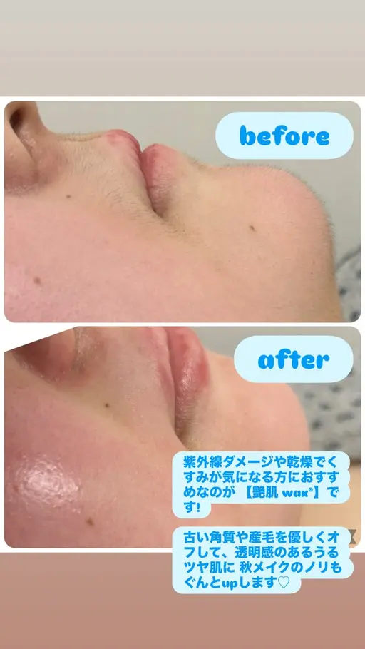 つるんと卵肌🌹産毛角質除去💎艶肌Wax💎