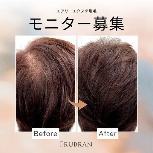 モニターモデル♪薄毛の悩みに！気軽にエクステ増毛体験♪ヘアカラーやパーマokでその日からふんわりボリュームUP