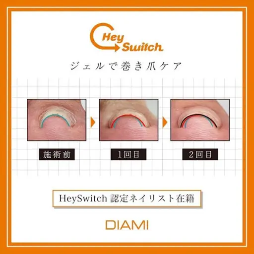 巻き爪ケア2本🦶特許取得の特殊ジェル✨Hey Switch✨