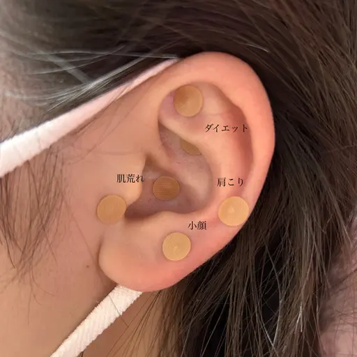 耳つぼ👂(ジュエリーなし)12粒