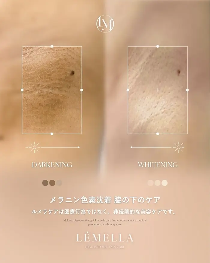 マツエク・まつげパーマデザインカタログ「メラニンケアLÉMELLA