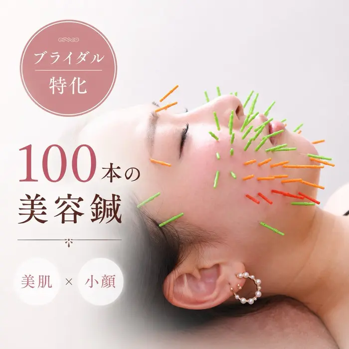 刺さない美容鍼♥440本　クーポン限定一万円セット！ 大阪上本町 肌質改善×美容鍼ゆいのプロフィール・予約(美容鍼灸Solana