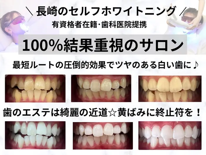 ホワイトニング ショップ長崎時津店のプロフィール・予約