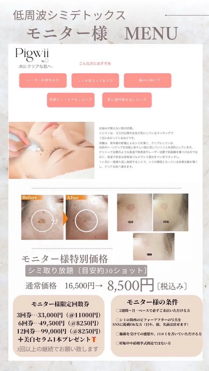 美容サロンカタログカタログ「低周波シミケアマシン