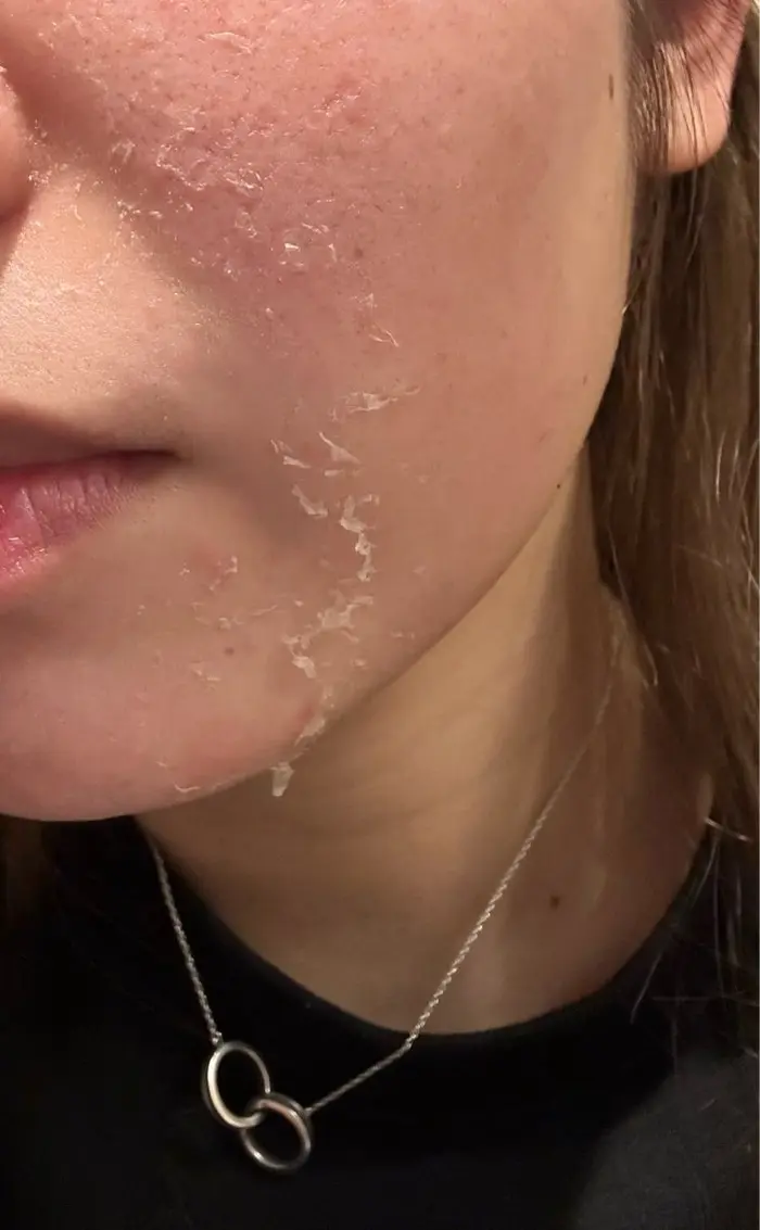 f2607169b2d9009f96f81a1644a3aa