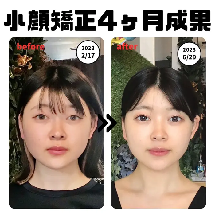 効果即実感小顔・骨盤矯正テクニック