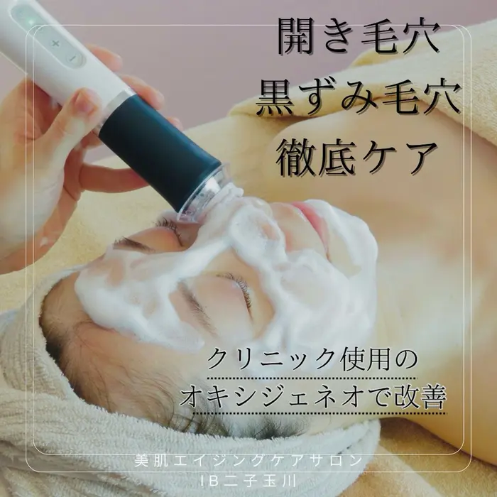 クリニックで使用されている炭酸毛穴洗浄ピーリング、 オキシ