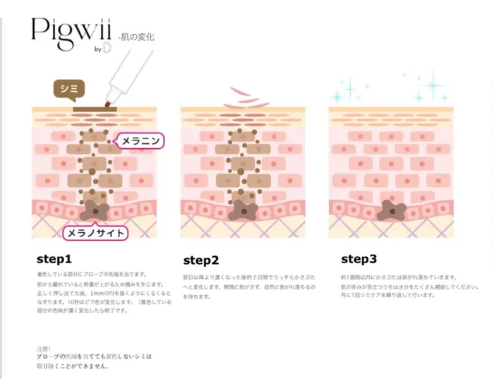 シミケア器 日本製 pigwii 低周波シミケアマシン
