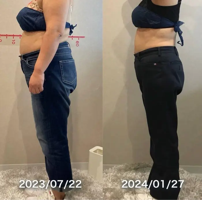 6ヶ月後のビフォーアフターになります｜脂肪冷却痩身サロン SHIFT 東京