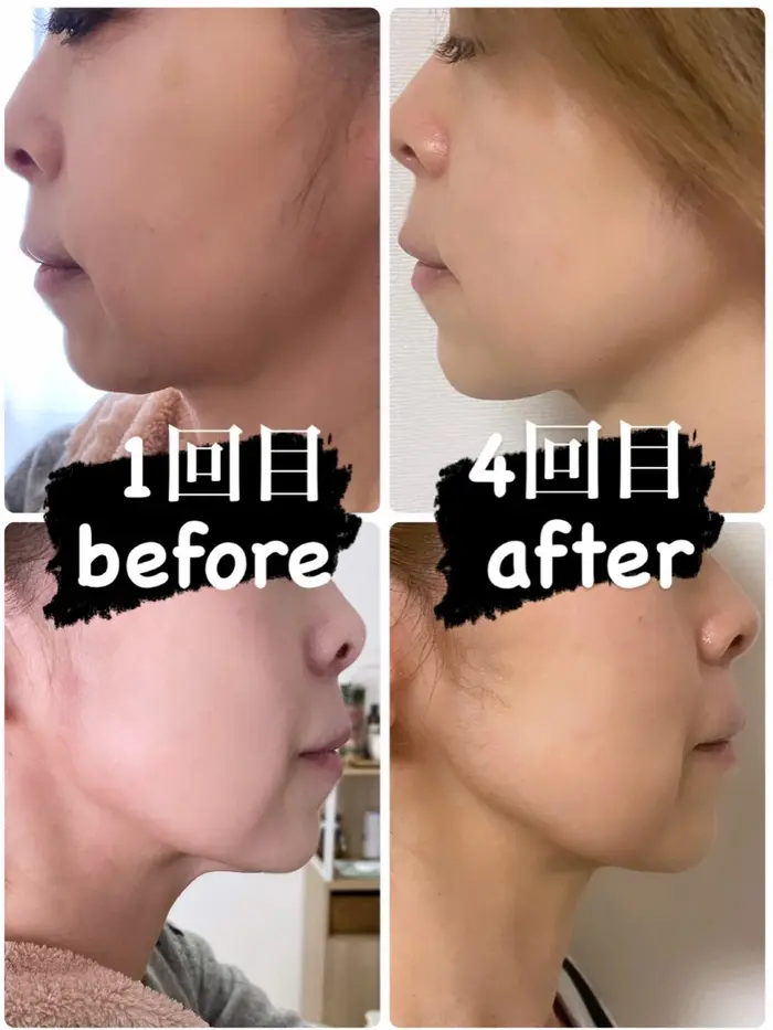 28d7f5872490ea7e45b5c23ca1af91