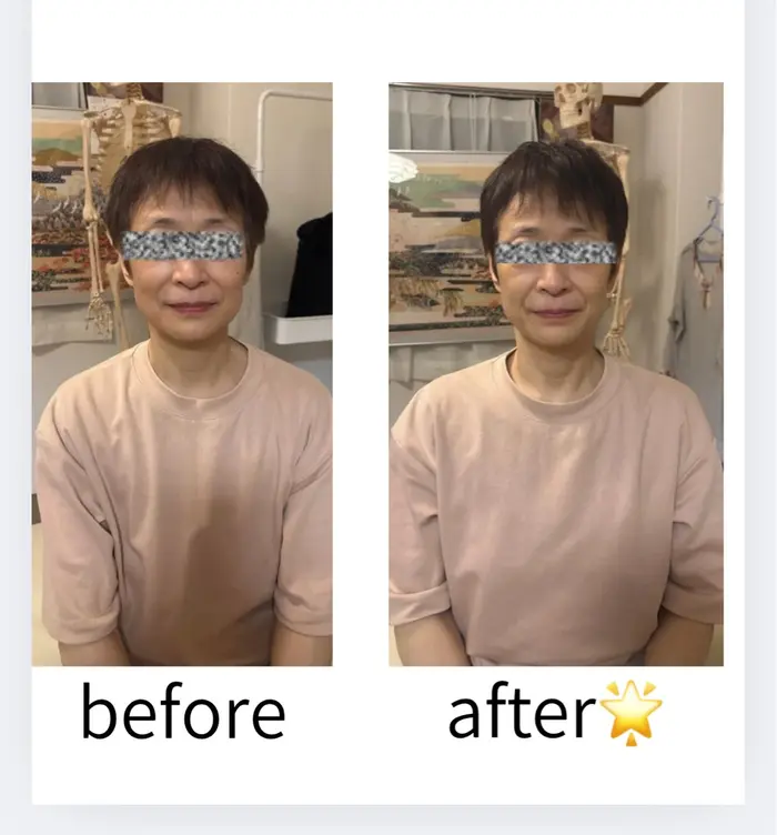 頭蓋骨矯正美容整体 今回はむくみが気になる方が来店されました♪ 右の