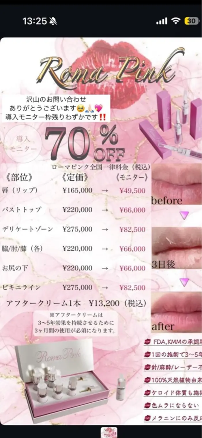 英子様♡ローマピンク ローマピンク1ヶ月後 before after｜RAGU BEAUTY所属・原口 彩子の