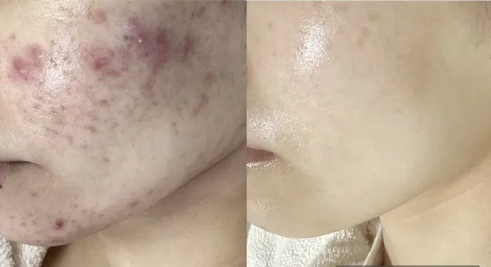 fabf05f982f17faddfaeec814817f8