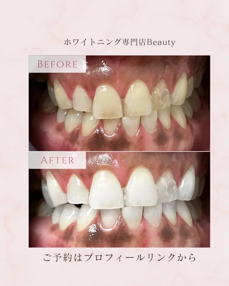 ホワイトニング&ネイル専門店Beautyの内観・外観3