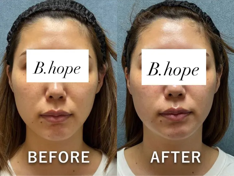 B.hopeの内観・外観3