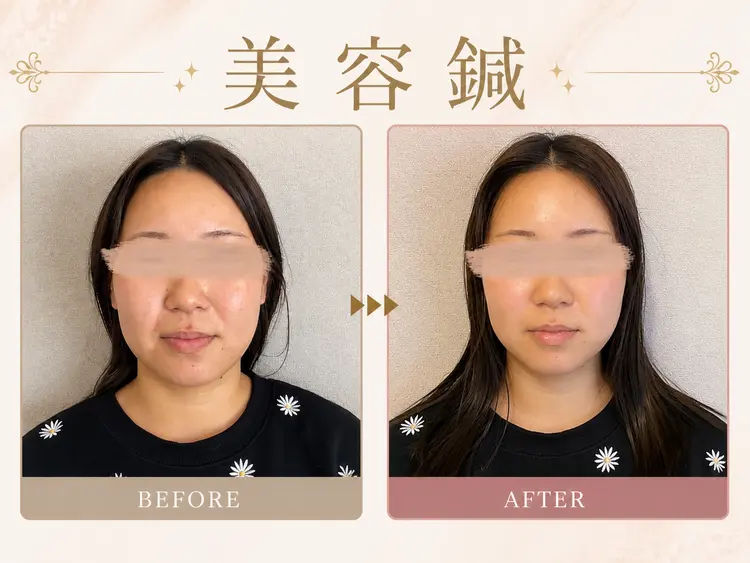 美容鍼灸整体サロンmemolaの内観・外観2