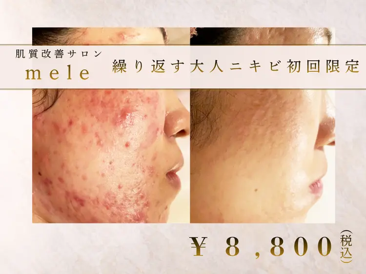 肌質改善サロン meleの内観・外観3