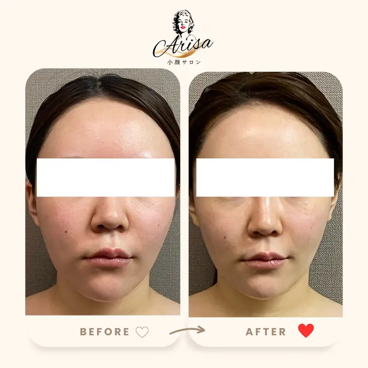 小顔サロンallilin銀座店の内観・外観2