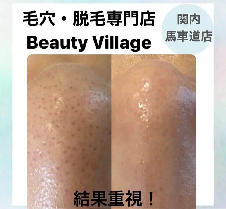 脱毛専門店《横浜•馬車道店》肌質改善の内観・外観1