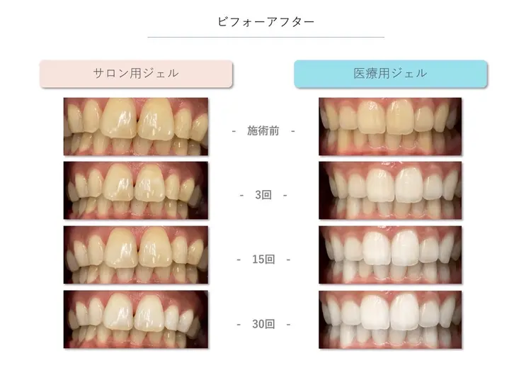 セルフホワイトニングサロン　Beteeの内観・外観3