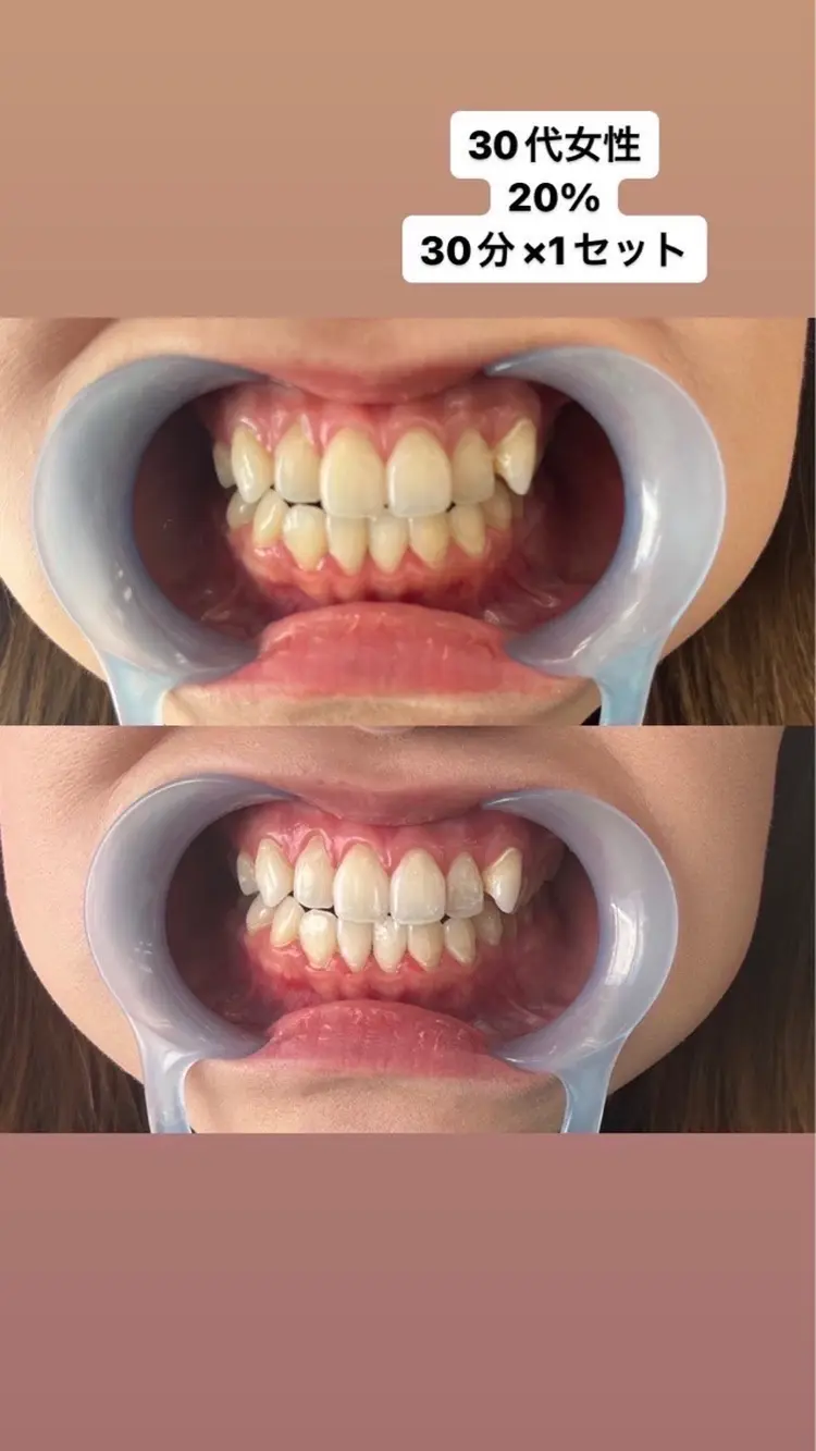 ララホワイトニング  大分駅前店の内観・外観1