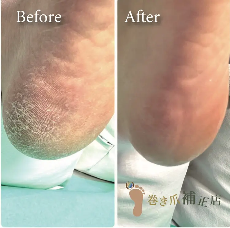 巻き爪補正店秋葉原店の内観・外観2