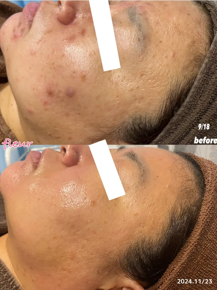 エステティックサロンFleurの内観・外観3