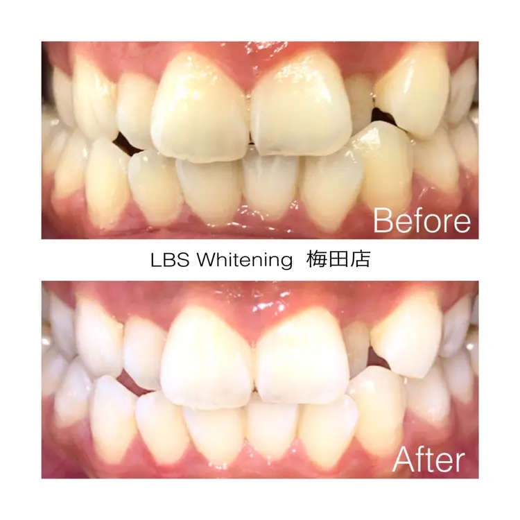 LBSホワイトニング梅田店の内観・外観3