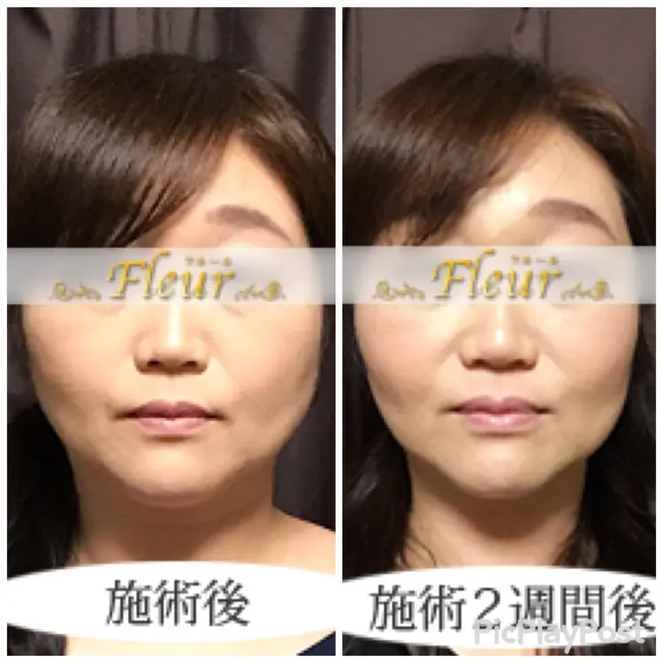 Faceline fleurの内観・外観3