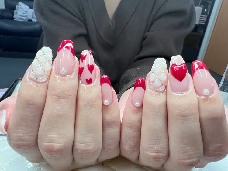 脱毛サロン優の画像