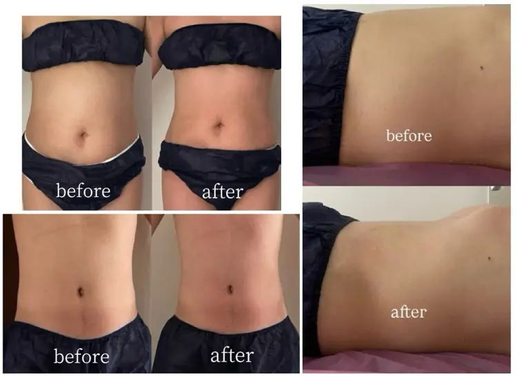 kiraraの内観・外観3