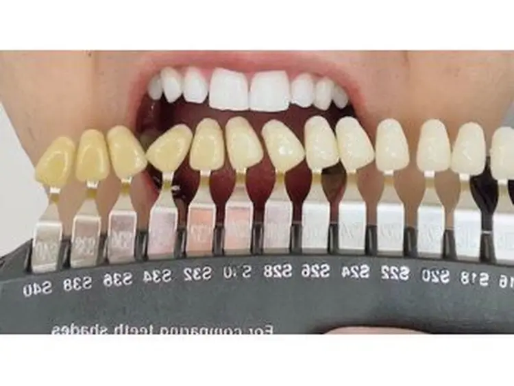 セルフホワイトニング エクシア戸田公園店の内観・外観3