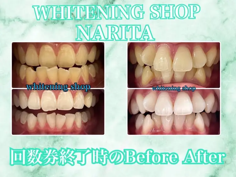 ホワイトニングショップ  成田店の内観・外観2