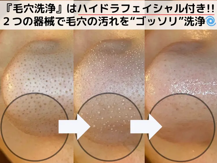 《毛穴洗浄・ハーブピーリング専門》シャルムクリニカルサロン池袋の内観・外観3