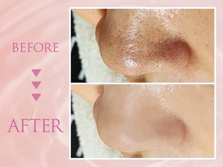 韓国肌管理専門店 Clear Labo クリアラボ 上野 【毛穴洗浄/ハイドラ/ピーリング】の内観・外観3