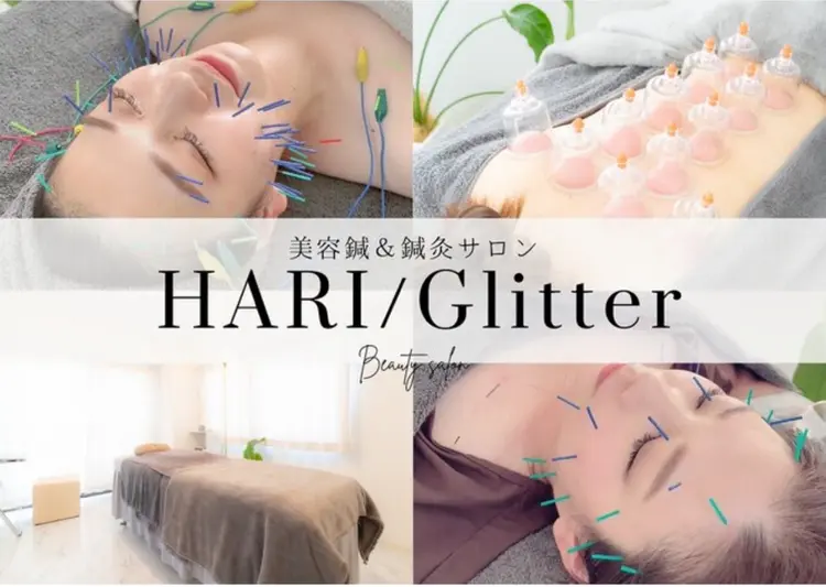 鍼グリッターの内観・外観1